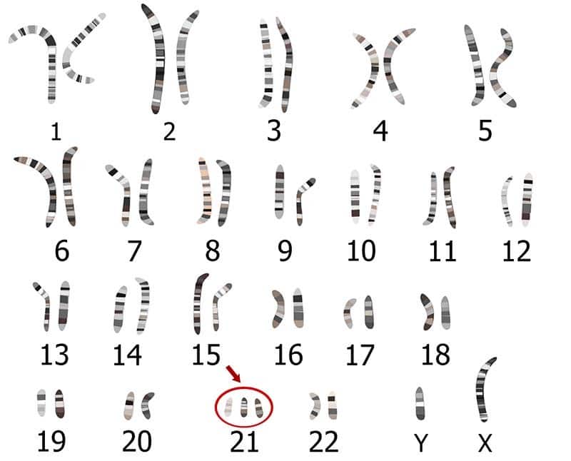 chromosoom nummer 21