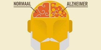 Ziekte van Alzheimer