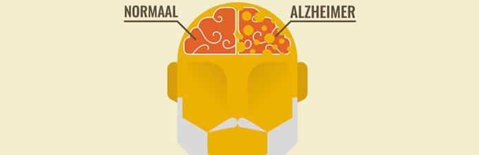 Ziekte van Alzheimer Ziekte van Alzheimer